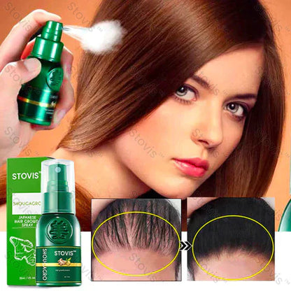 STOVIS™ ⭐⭐⭐⭐PRO SPRAY  CRECIMIENTO DE CABELLO