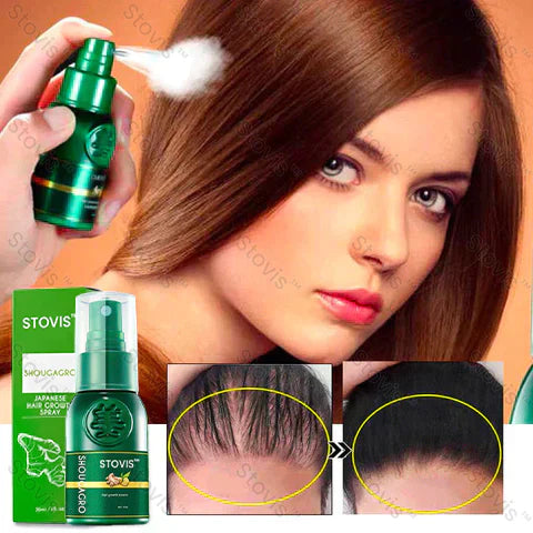 STOVIS™ ⭐⭐⭐⭐PRO SPRAY  CRECIMIENTO DE CABELLO